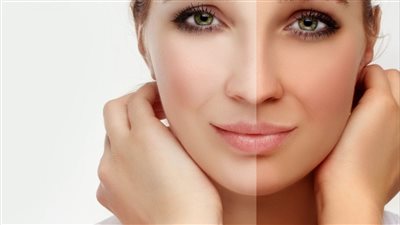  أخصائية جلدية تكشف أحدث الطرق لعلاج توحيد البشرة وإزالة الكلف