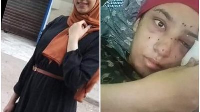هتمد إيدك على عيل.. فقأ عين فتاة لدفاعها عن طفل بـ الإسماعيلية