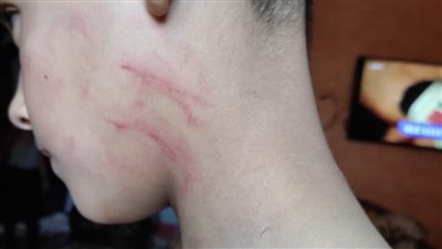 ضحية الانفصال.. تفاصيل تعذيب طفل بكابل كهرباء على يد والده بالشرقية | صور