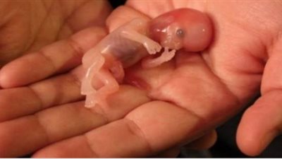 من خلال نظارات الواقع الافتراضي.. باحثون يطورون تقنية للتنبؤ بحالات الحمل المنتهية بإجهاض