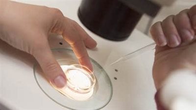 ما حكم الدين في عملية الإخصاب الصناعي الثلاثي؟.. الإفتاء تجيب