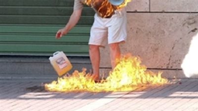 جاتله في المنام.. أيمن تعلق بوالدته فأشعل النيران في جسده ليلحق بها | فيديو