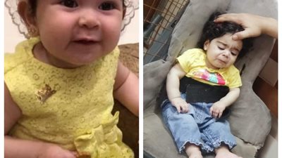 أعراض الضمور العضلي بعد وفاة طفلتين بسببه.. استشاري مخ وأعصاب يوضح