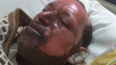 شاب يعتدي على والدته ويشعل النار في خاله بالغربية