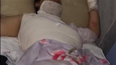 محامي ضحية والدها بكفر الشيخ: المتهم سبق الحكم عليه بـ25 سنة سجن في قضايا حرق| مستندات 