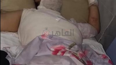 حبس المتهم بحرق ابنته بكفر الشيخ 15 يومًا على ذمة التحقيقات 