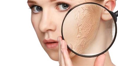 إخصائية أمراض جلدية تضع روشتة لحماية البشرة من الجفاف