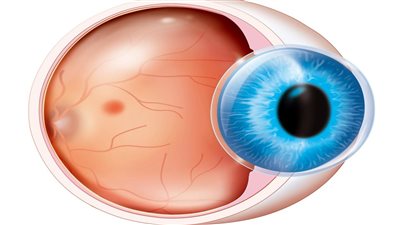 استشاري حراجة العيون يوضح شروط التبرع بالقرنية