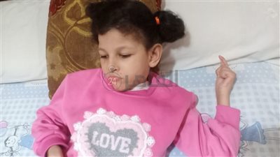 مأساة طفلة في عمر الزهور مصابة بضمور بالمخ.. وأسرتها: نفسنا السيسي يتدخل وينقذها