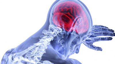 دراسة: مرضى كورونا يعانون مشاكل في الدماغ بعد عامين من الإصابة 