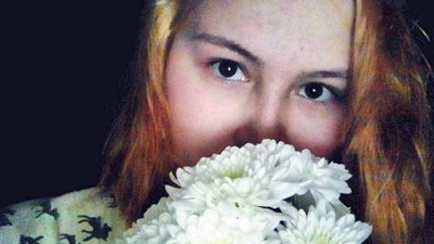 بسبب الغيرة.. مراهقتان تشتركان في تمزيق صديقتهما بزجاج مكسور (صور)