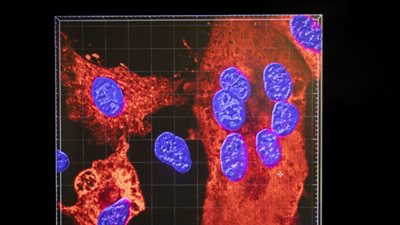 إسرائيل تعلن العثور على أول حالة مصابة بسلالة متحورة من متغير دلتا 