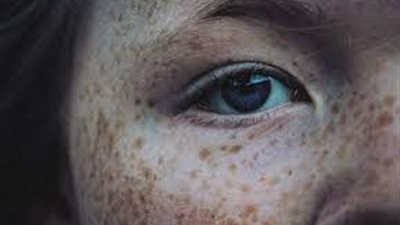  تعرف على أسباب وعلاج متلازمة كارني