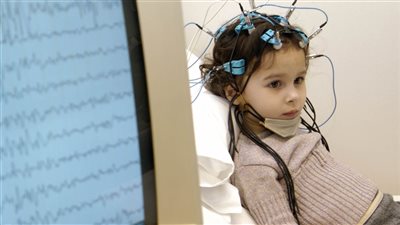 الصرع عند الأطفال.. 7 نصائح للتعامل مع المصابين