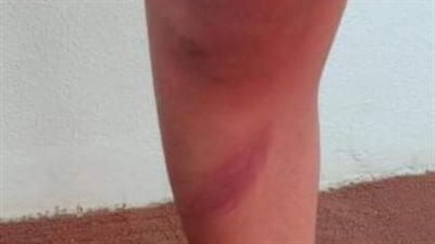 عشان مش بياخد عنده درس.. ولية أمر تستغيث بعد ضرب مدرس ابنها في مدرسة بالقاهرة