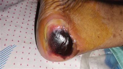 مصاب بمرض نادر..والابن يستغيث بوزارة الصحة