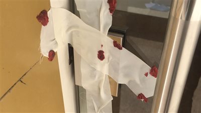 الصحة: إغلاق 59 مركزًا خاصًا مخالفًا لعلاج الإدمان ب 6 محافظات خلال شهر