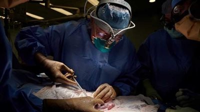 محامي يتقدم بطلب لوزيرة الصحة باعتماد زراعة كلى الخنزير لمرضى الفشل الكلوي