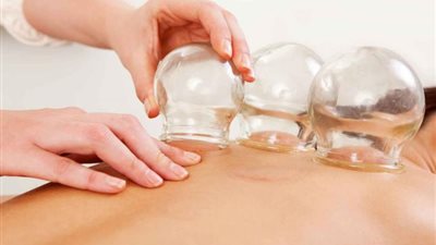 ذاكرة الأمثال.. اتعلم الحجامة في روس اليتامى