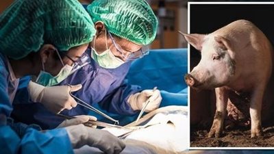 الأزهر يحسم الجدل بشأن حرمانية زراعة كلى الخنزير داخل جسد الإنسان