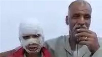 شخص يشعل النيران في جلابية ويلقيها على طفل بسوهاج.. والضحية: عاوز حقي
