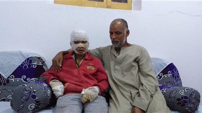بعد نشر القاهرة 24.. محافظ سوهاج يوجه برعاية الطفل صاحب واقعة الجلباب المحروق بطهطا