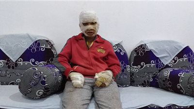  تفاصيل إشعال مُسن النار في طفل بسوهاج | فيديو وصور