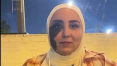 شبيهة شخصية لقاء الخميسي في حدوتة حتة من القمر تتعرض للتنمر بسبب الوحمة