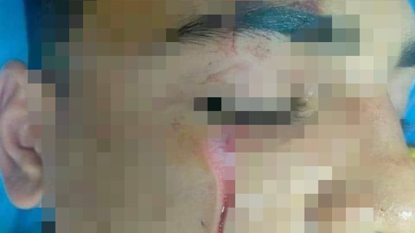 الطالب المصاب 