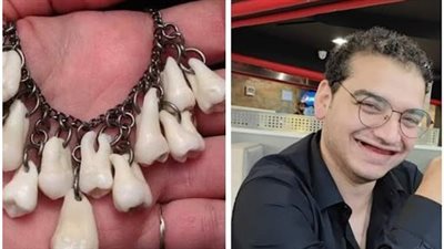 بعد اختفائه 3 سنوات.. صاحب تريند كايا وسارة يثير الجدل بـ إهداء أسنانه لحبيبته