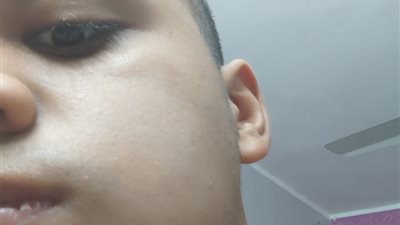 إحالة واقعة تعد طالب على زميلة وكسر فكه داخل مدرسة بشبرا الخيمة إلى التحقيق