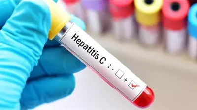 الصحة: علاج أكثر من 4.1 مليون حالة مصابة بفيروس سي