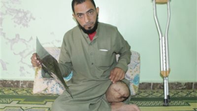 شاب بالمنوفية: فقدت قدمي بسبب خطأ طبي.. وأناشد المحافظ بتعديل مكان الكشك مصدر رزقي