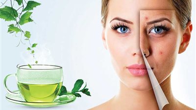 من بينها تقليل الانتفاخات ومعالجة حب الشباب.. تعرفي على فوائد الشاي الأخضر للبشرة