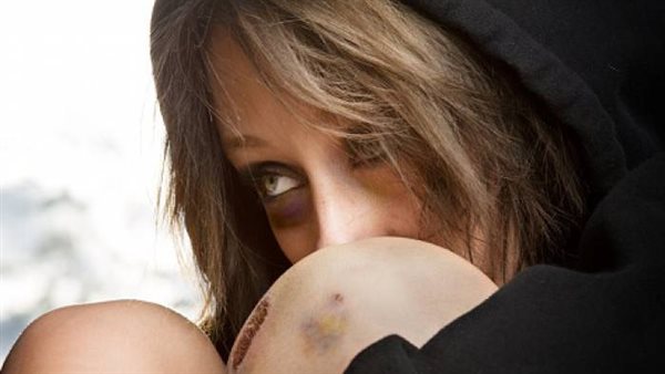 ضحية المنفعة الجنسية