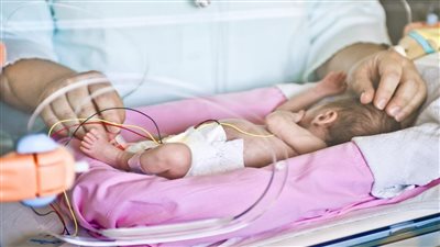 في اليوم العالمي للولادات المبكرة.. أبرز نصائح وإرشادات خطر الإنجاب المتكرر| فيديو