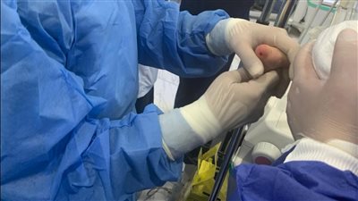 الصحة: فحص 123 ألف طفل حديث الولادة ضمن مبادرة للكشف المبكر عن الأمراض الوراثية