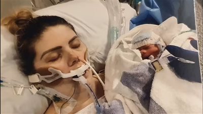 احتضنته بعد ولادته بـ 11 أسبوعا.. مصابة بفيروس كورونا تلد طفلها قيصريًا وهي بغيبوبة