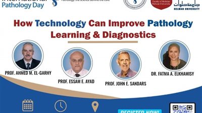 بحضور المتخصصين من 11 دولة.. طب حلوان تحتفل باليوم العالمي للباثولوجي