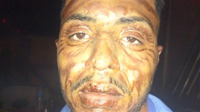 ضحية لقمة العيش.. النيران تلتهم جسد شاب إثر حريق في بورسعيد