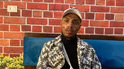 التهمت النيران وجهه.. شاب يروي تفاصيل إصابته أثناء عمله بشوي الأسماك |فيديو