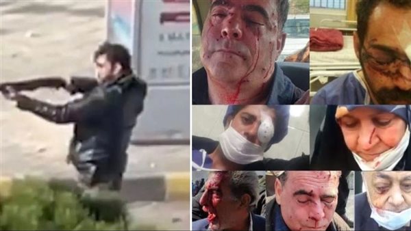 اقتلاع أعين المحتجين