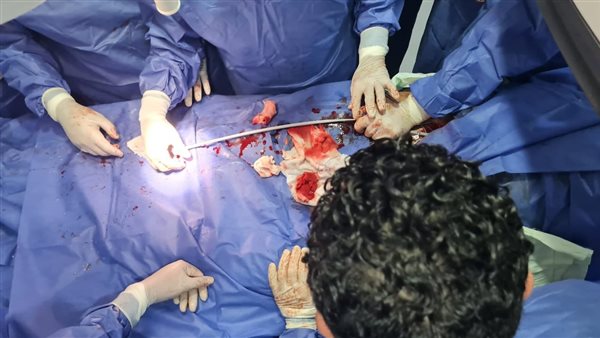 أثناء إجراء العملية