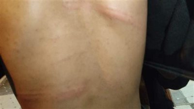 مدرس يعتدي على طالب ثانوي بالضرب داخل سنتر دروس خصوصية بالمحلة