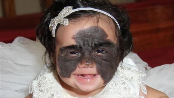 الطفلة لونا تافاريس