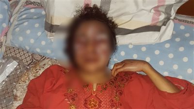 لمطالبتها بمصاريف الولادة.. زوج يعذب زوجته لمدة 13 ساعة معلّقه في «جنش» سقف المروحة بأسوان 