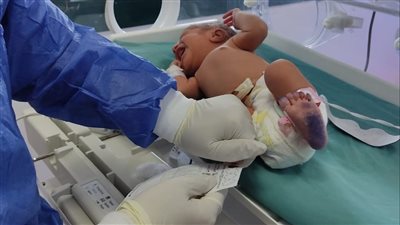 الصحة: فحص 154 ألف طفل حديث الولادة ضمن مبادرة الكشف المبكر عن الأمراض الوراثية