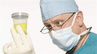 5 علامات ضمن أعراض صديد البول ونسبته في التحليل الصباحي 