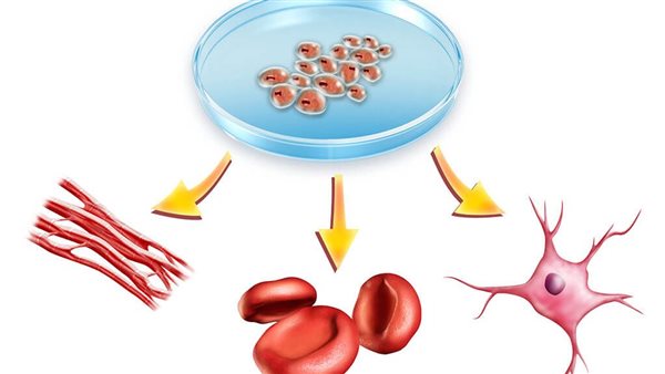 العلاج بالخلايا الجذعية