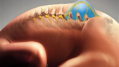 نفسي أنقذ بنتي.. سيدة تستغيث بالمسؤولين لتوفير علاج لطفلتها المصابة بالصلب المشقوق | صور